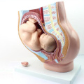 ANATOMY11 (12449) Median Section Human Female Pelvis Section with 9 Month Infant